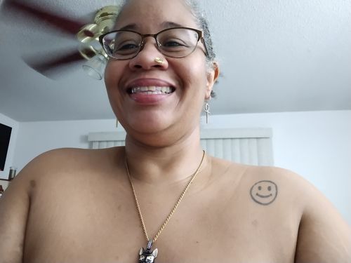 Customer photo review of Nose Cuffs