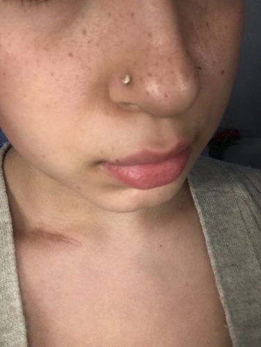 Customer photo review of L-Tennis Nasenstecker | 316L Edelstahl