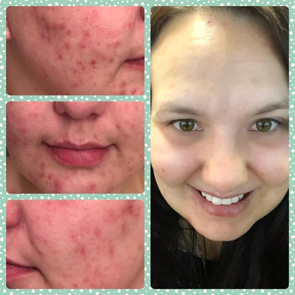 Customer photo review of Deluxe Set