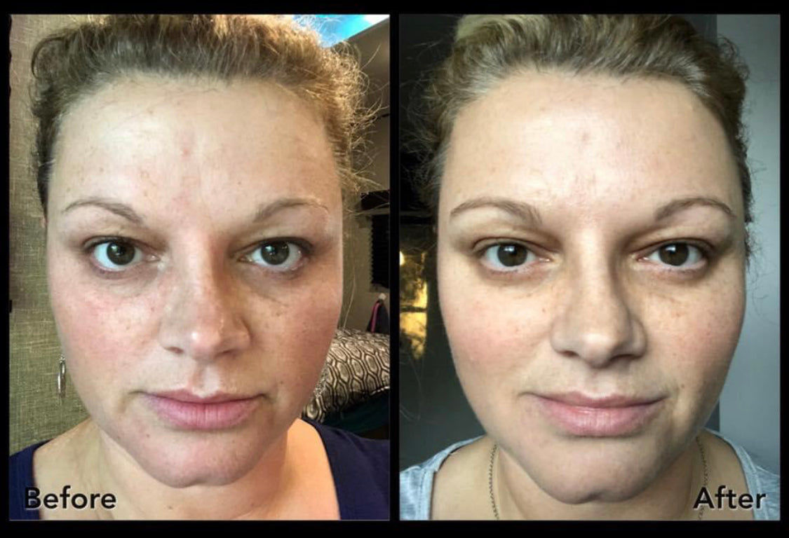 Customer photo review of Deluxe Set