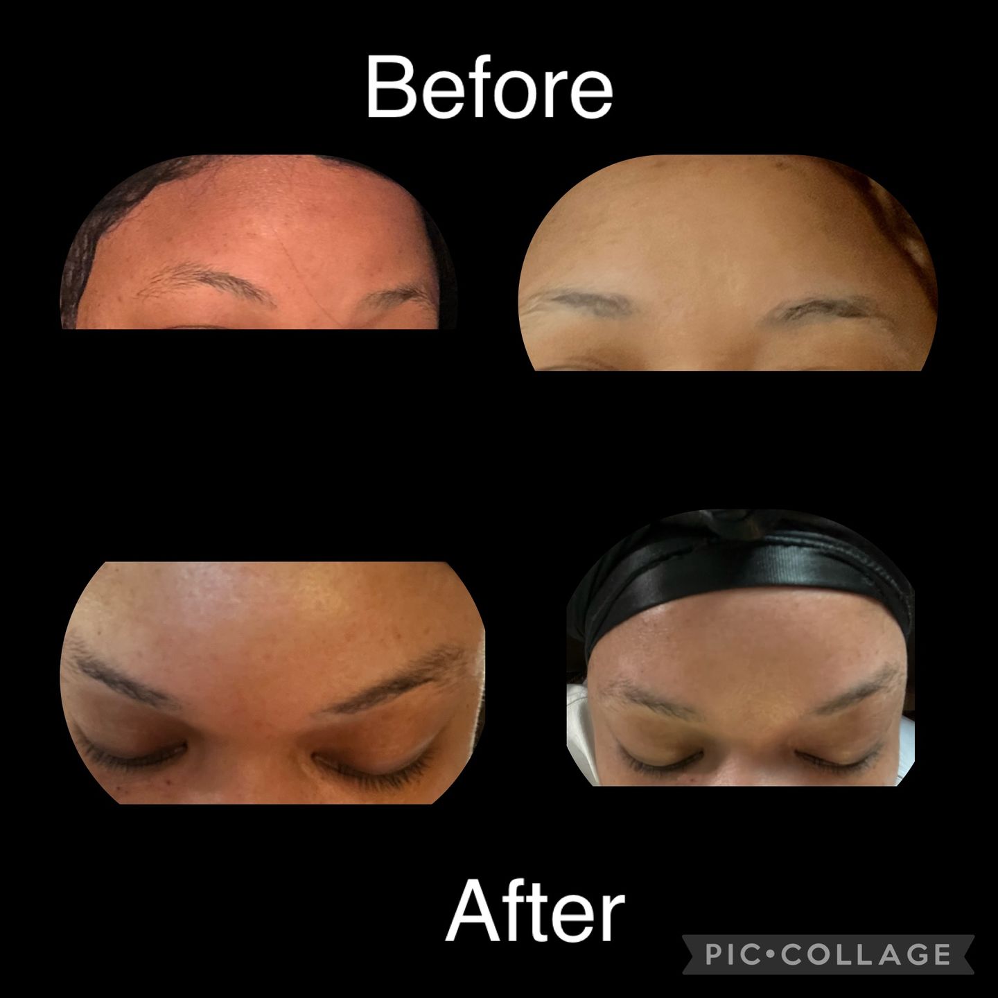 Customer photo review of Volume Eyebrow and Eyelash Serum -