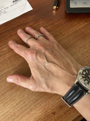 Customer photo review of Pack Hidro-K Día + Hidro-K Noche + Antiox+