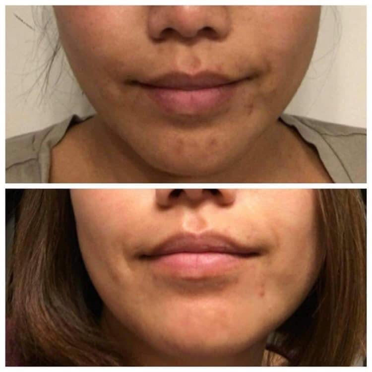 Customer photo review of Deluxe Set