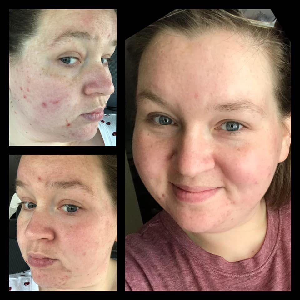 Customer photo review of Deluxe Set