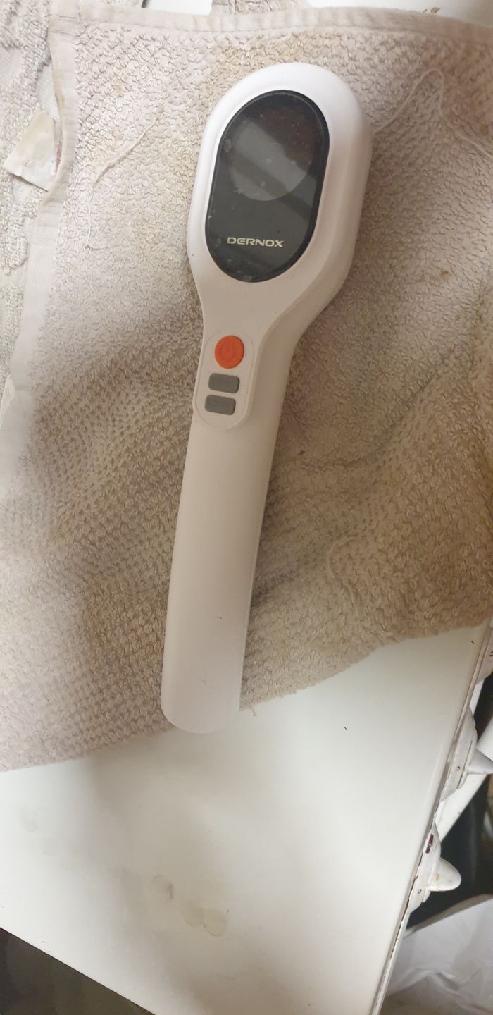 Customer photo review of DERNOX™ Handheld Pain Relief Cold Laser Device