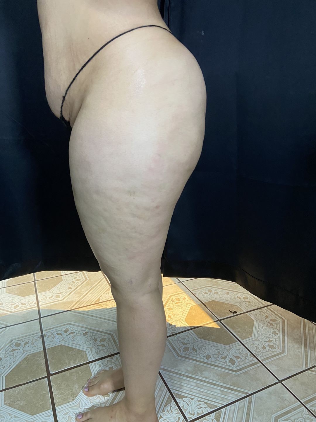 Customer photo review of Lipolimus Extracto de Alcachofa - Denova - Adelgazante y Anticelulítico