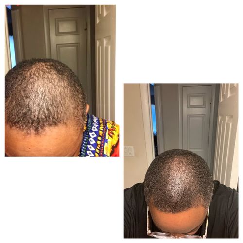 Customer photo review of Moisture Sealing Whipped Hair Butter