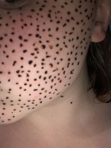 Customer photo review of Henna Cone Bottle - For Faux Freckles and Tattoos