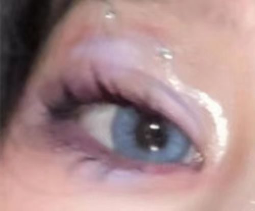 Customer photo review of Aurora Azul Blue Colored Contacts