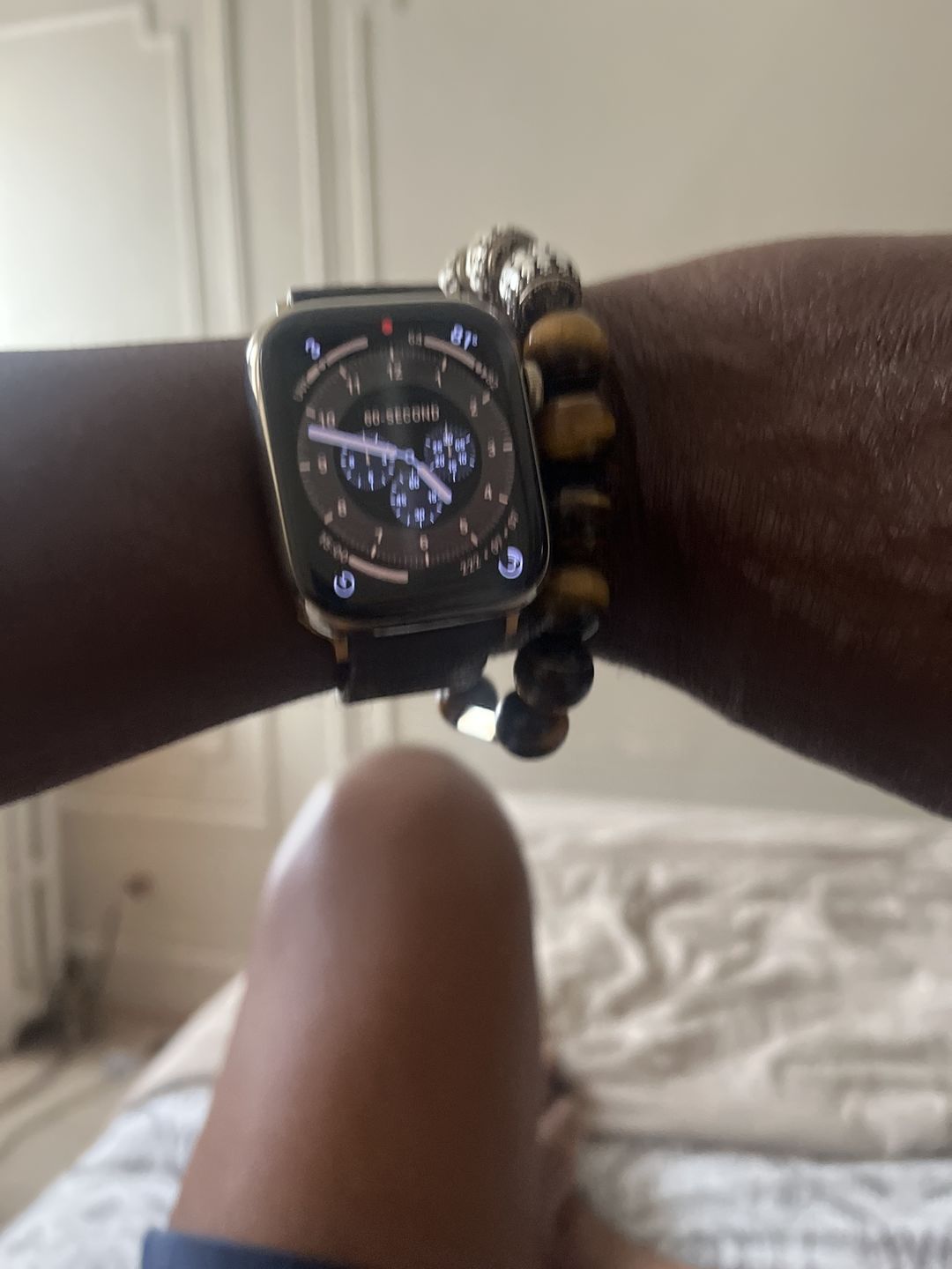 Customer photo review of Apple Watch Band Classic LV Monogram