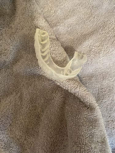 Customer photo review of Annual Plan – One night guard shipped every three months