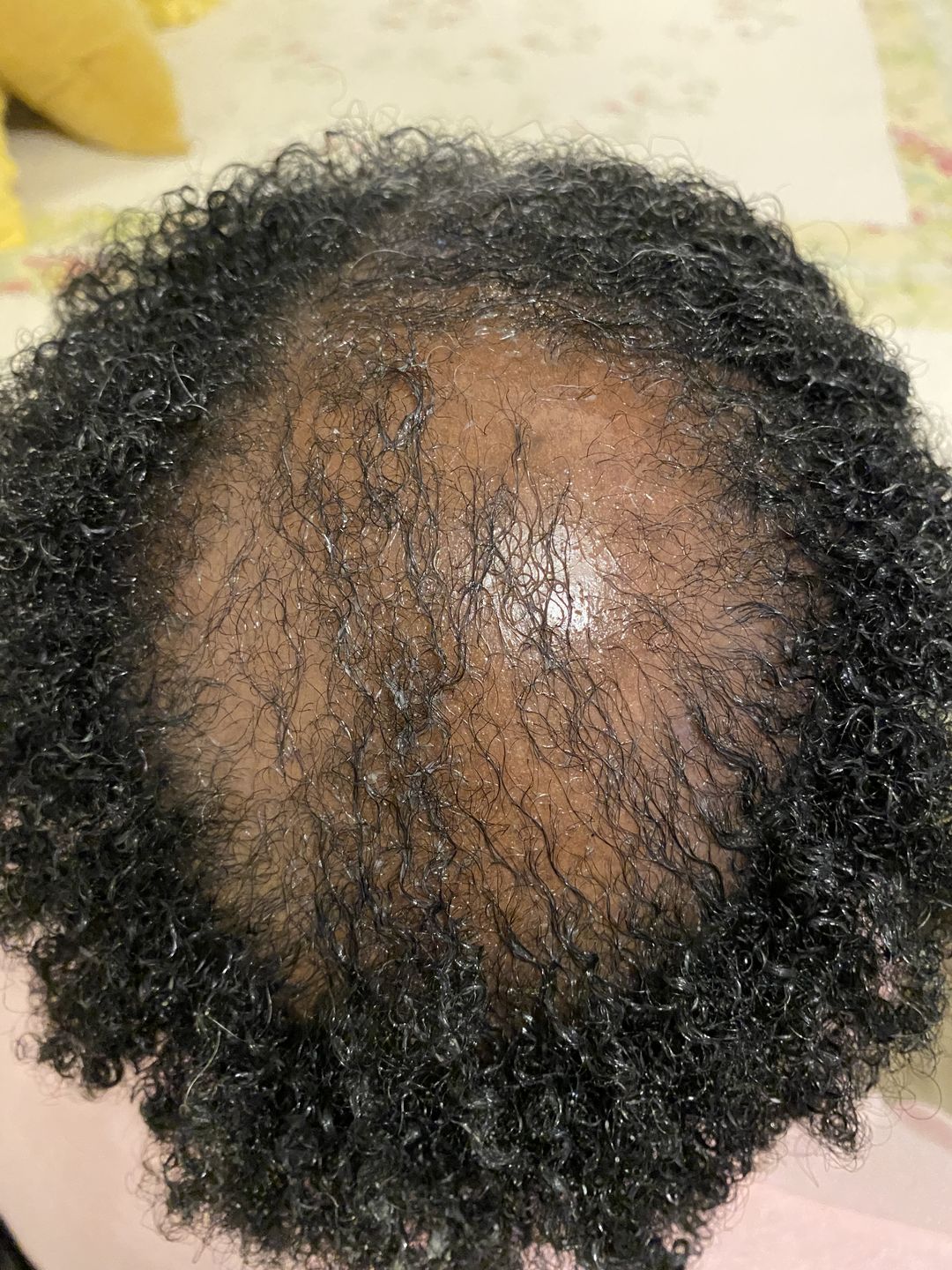 Customer photo review of Scalp Massager