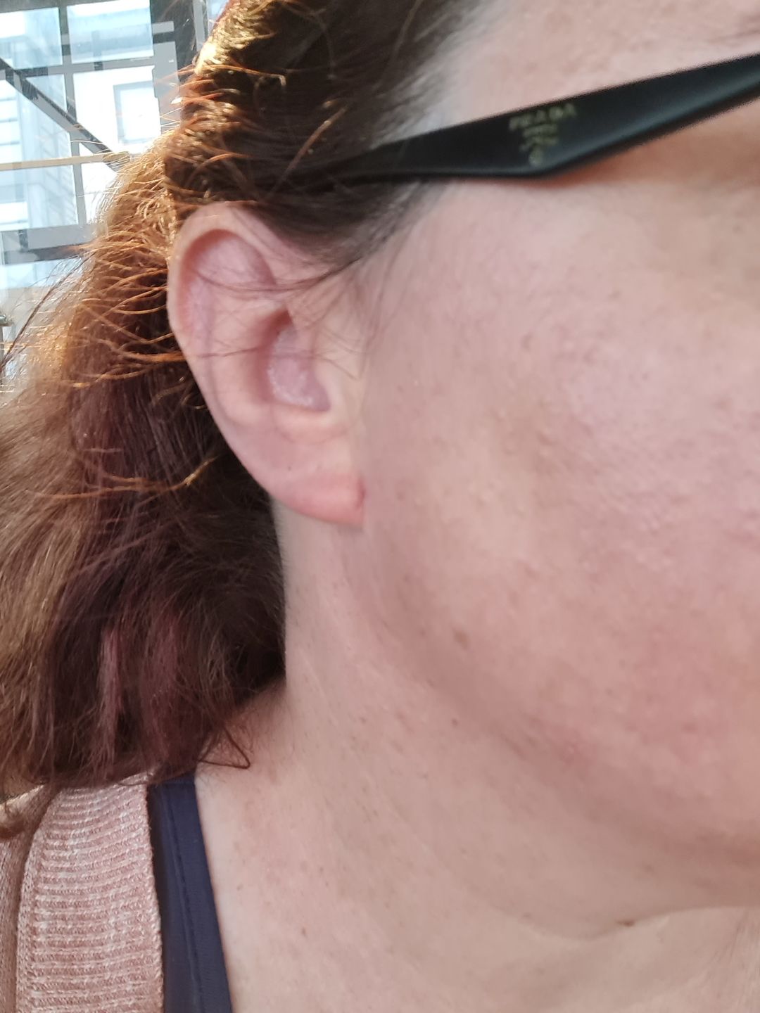 Customer photo review of Antiac Activ Liquid Spray