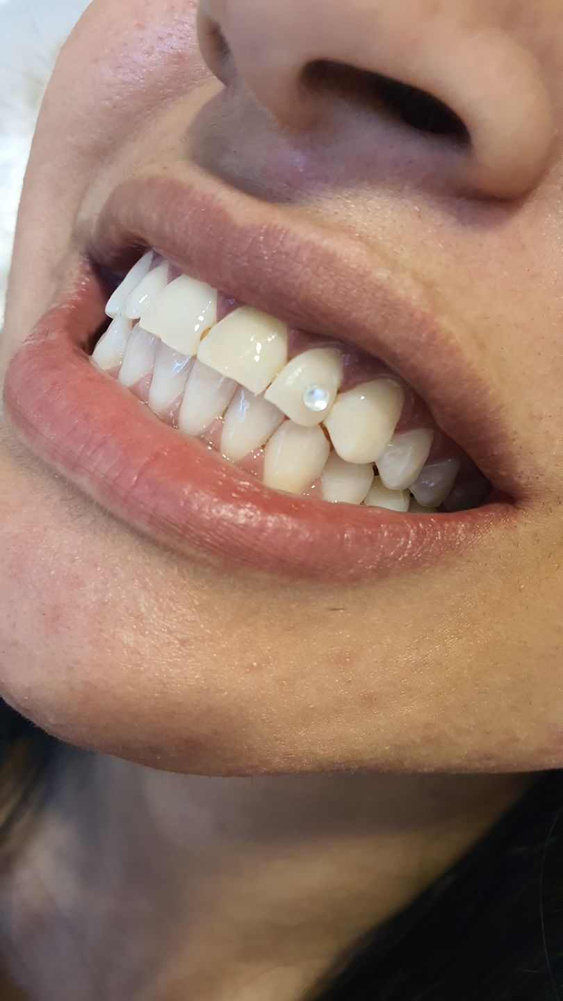 Customer photo review of Crystal Clear 2.7mm 5-pack