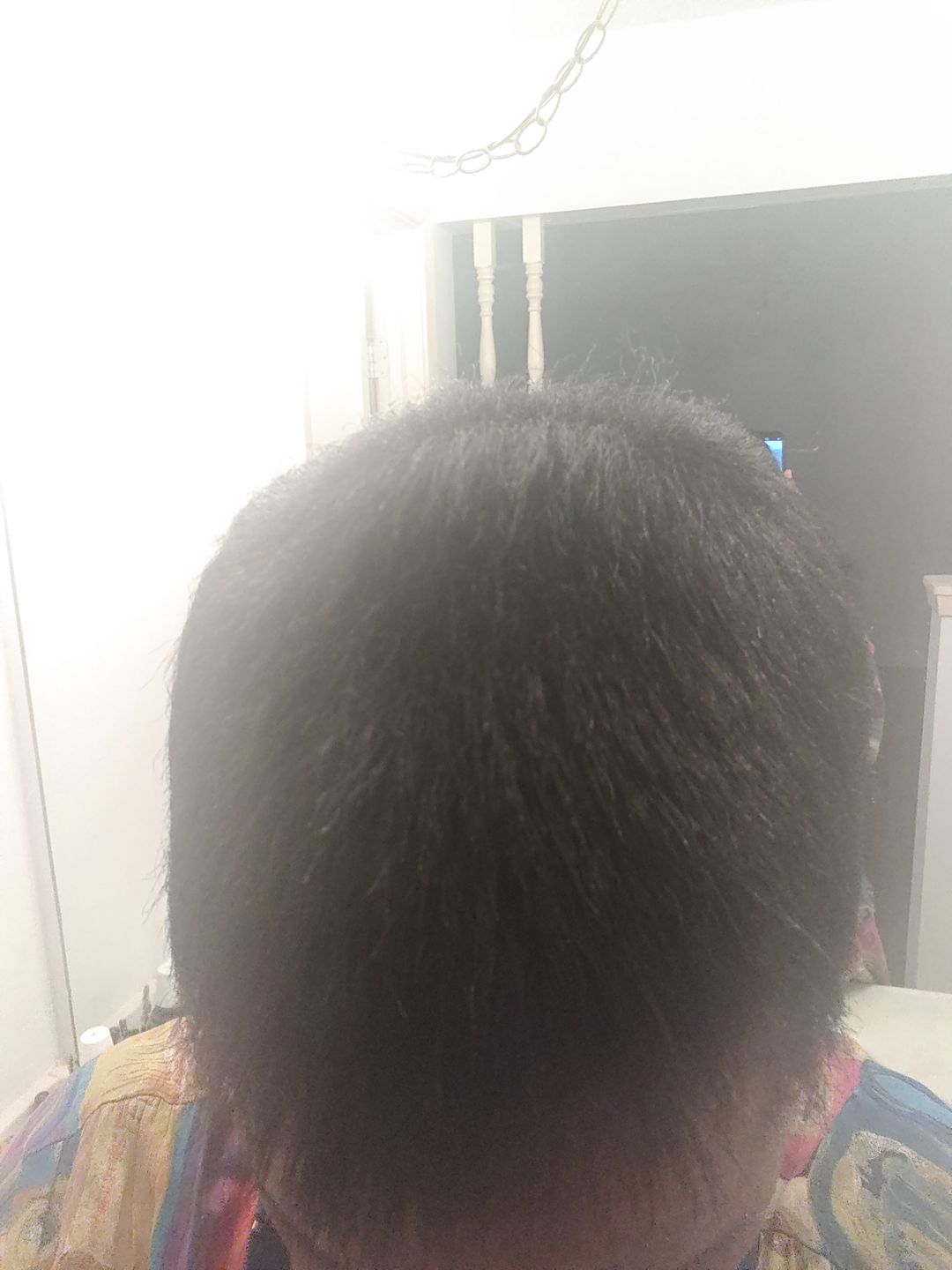 Customer photo review of Super G  Vital Growth Serum Water-based scalp serum infused with white willow bark