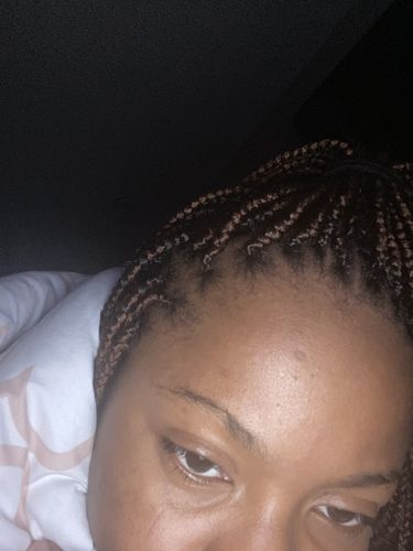Customer photo review of Rice Water Scalp Mist (PreMade)