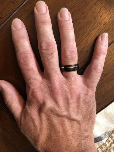 Customer photo review of Ring Exchange