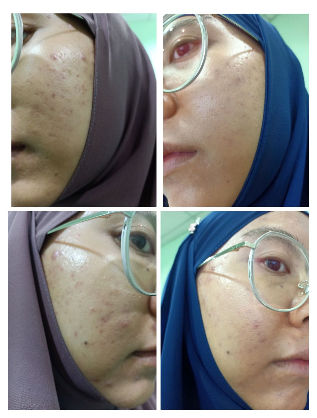 Customer photo review of Face Set