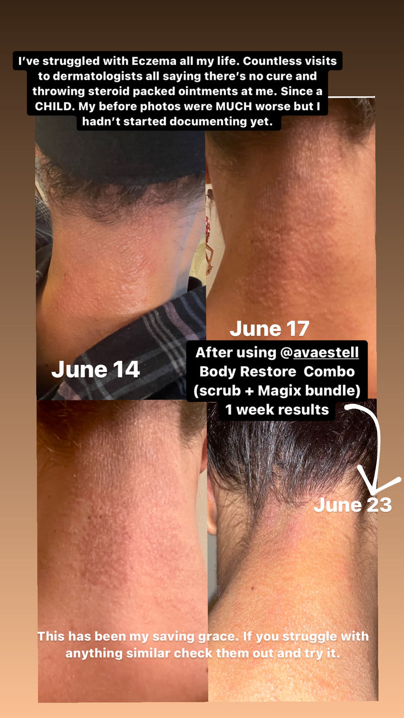 Customer photo review of Magix Cream