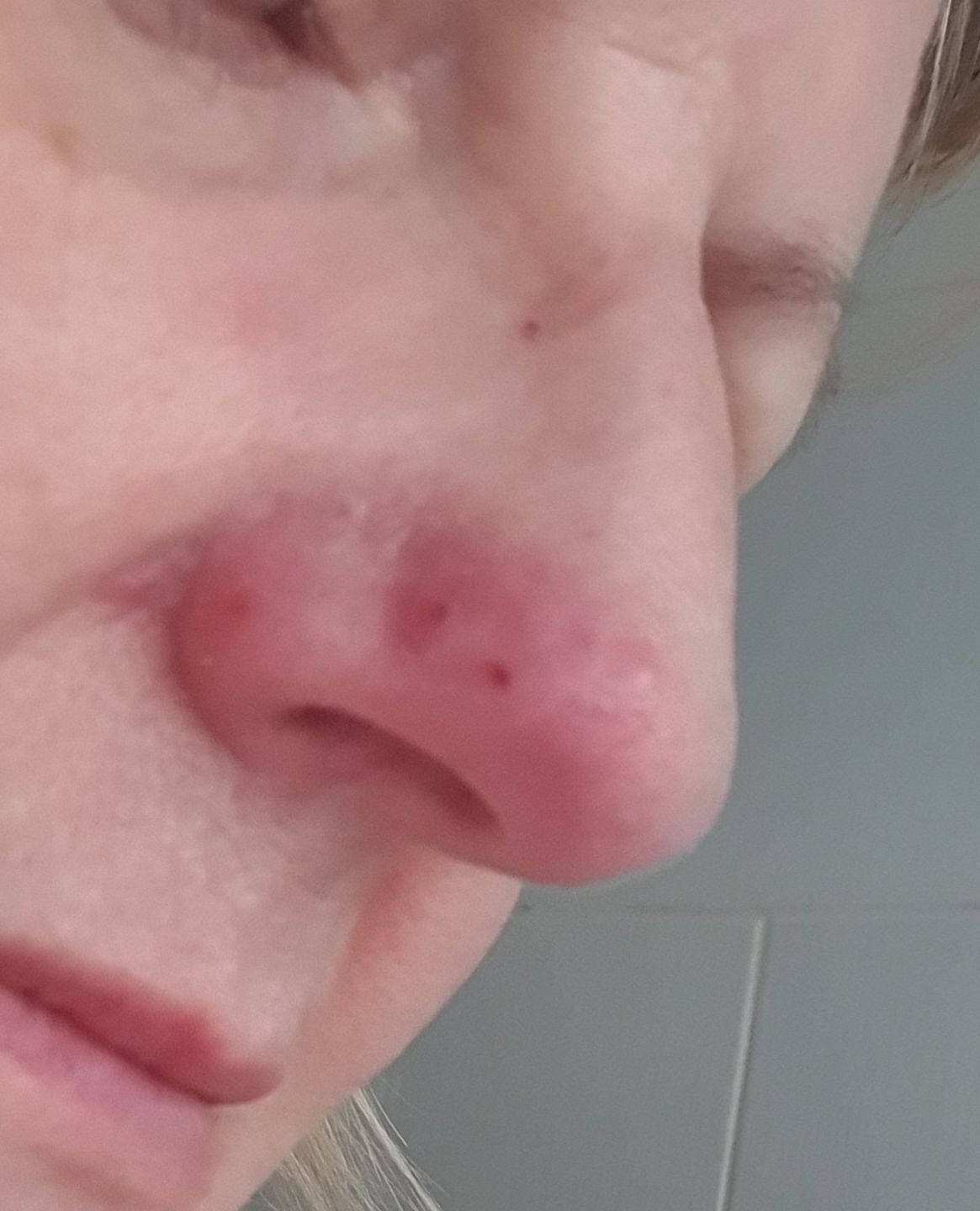 Customer photo review of Healing Miracle Cream