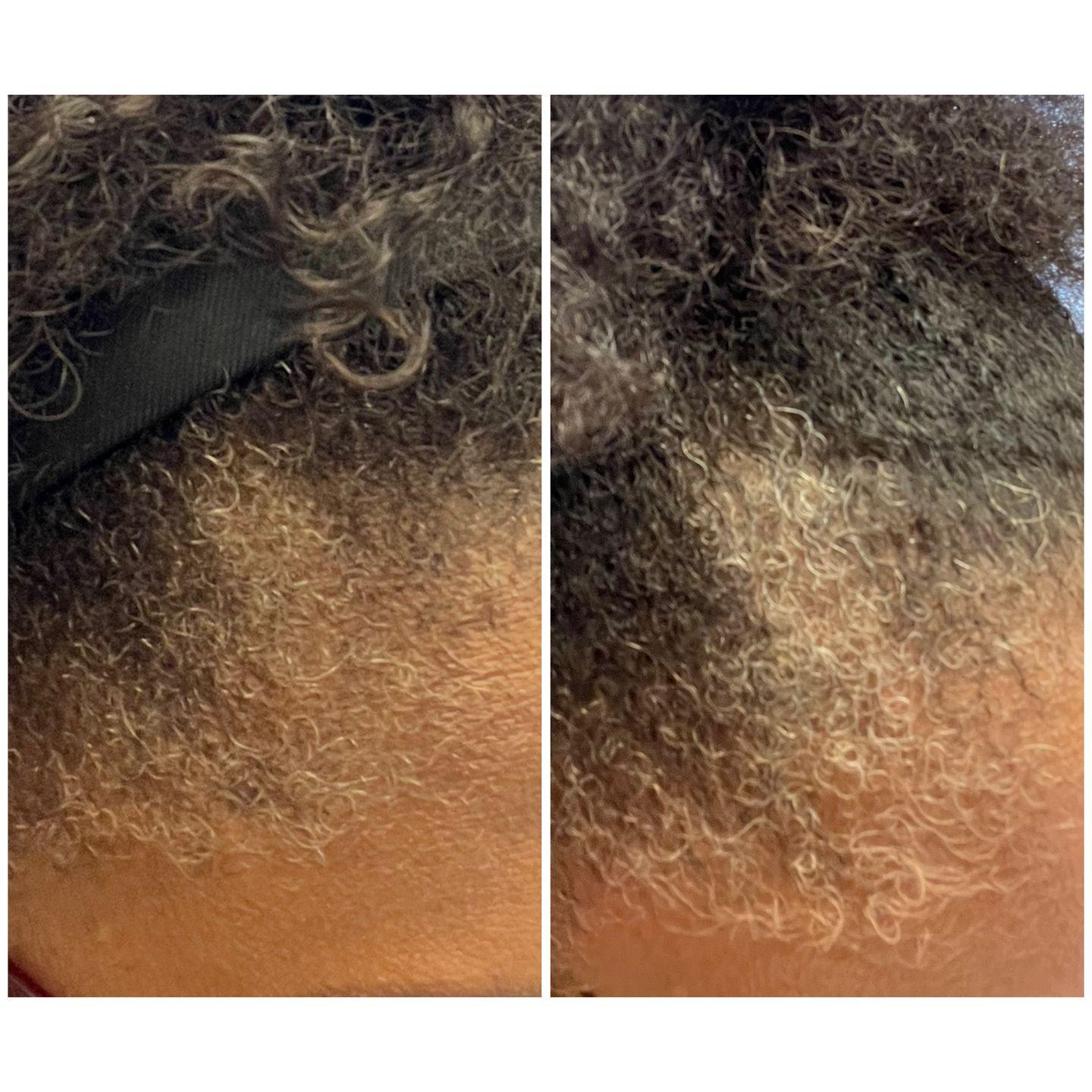 Customer photo review of Super G  Vital Growth Serum Water-based scalp serum infused with white willow bark