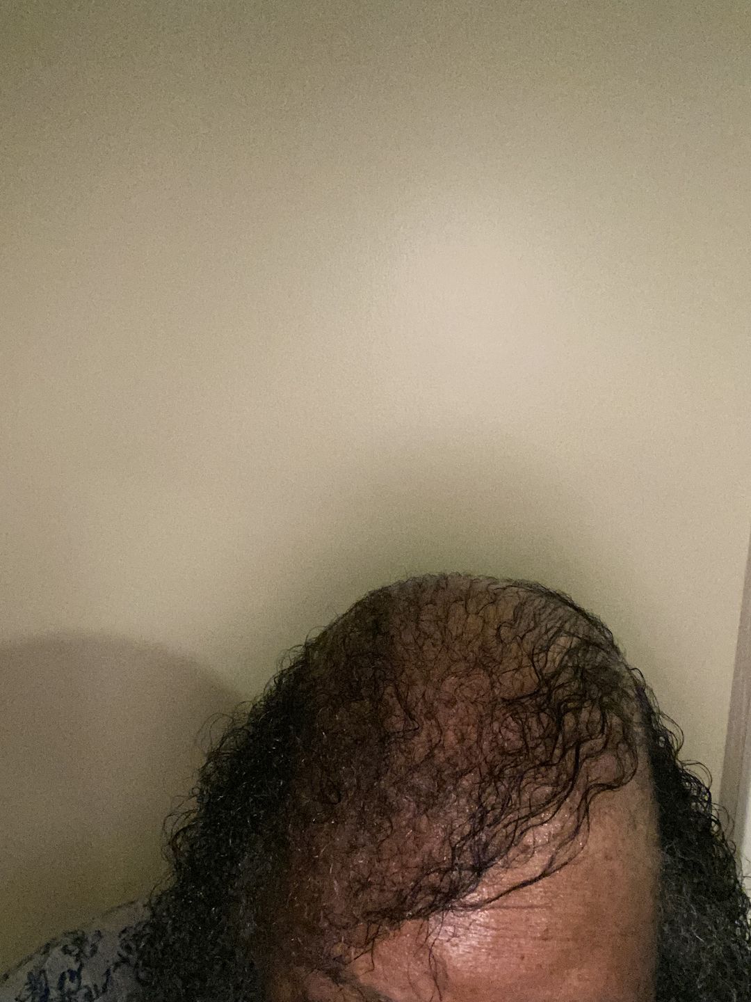Customer photo review of CAFFEINE INFUSED HAIR GROWTH BUTTER