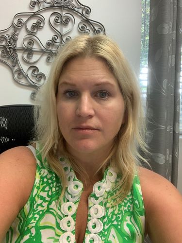 Customer photo review of Sunkissed Self-Tanning Serum