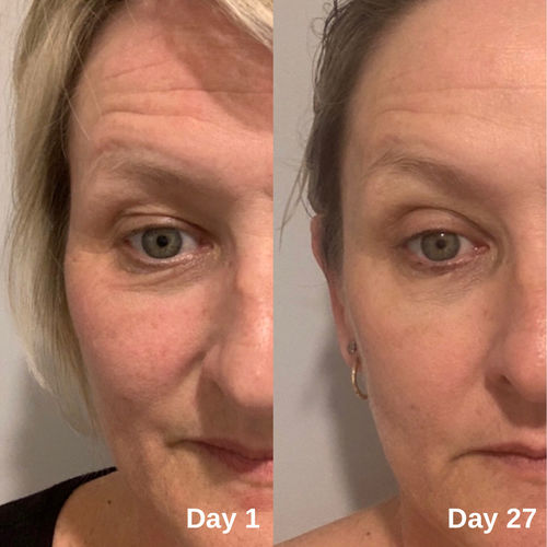 Customer photo review of NAKED Anti Ageing Serum