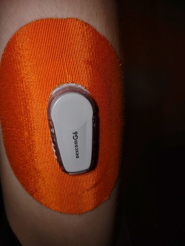Customer photo review of Skin Grip Dexcom G6 Patches