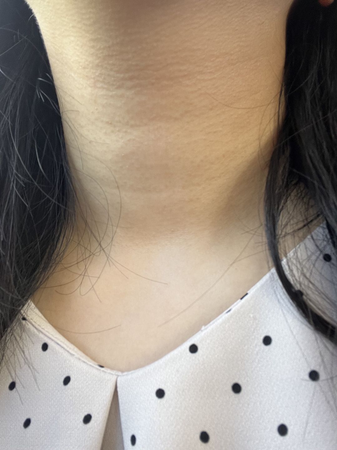 Customer photo review of Blueberry Vitamin C Serum