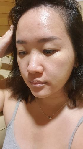 Customer photo review of Niacid