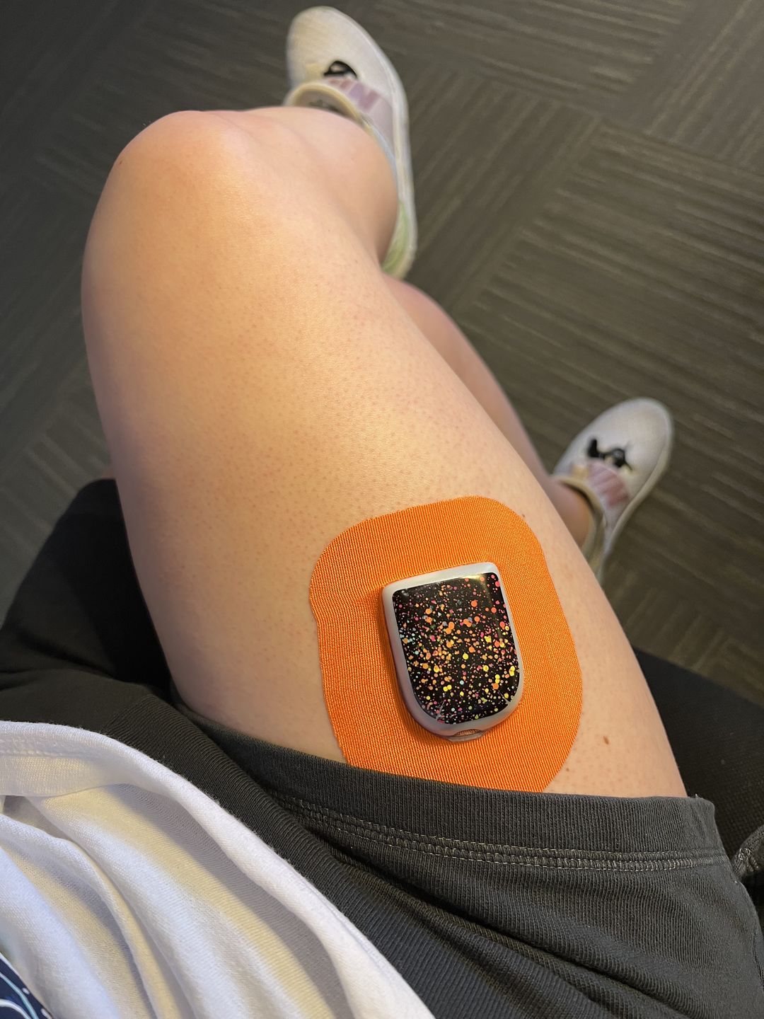 Customer photo review of Skin Grip Omnipod Adhesive Patches