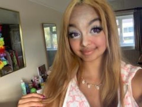 Customer photo review of Raven Contact Lenses(12 months of use)