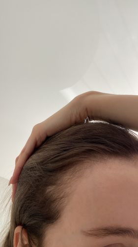 Customer photo review of Growth & Shine Hair Oil