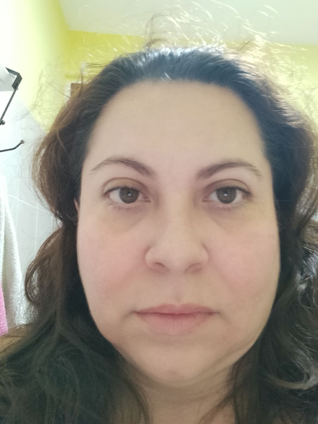 Customer photo review of Opuntia Facial Serum / Suero Facial Opuntia
