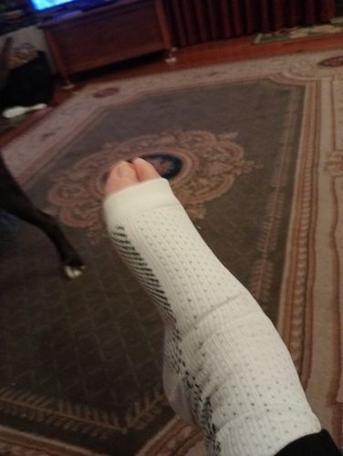 Customer photo review of Buy 1 NeuroSocks
