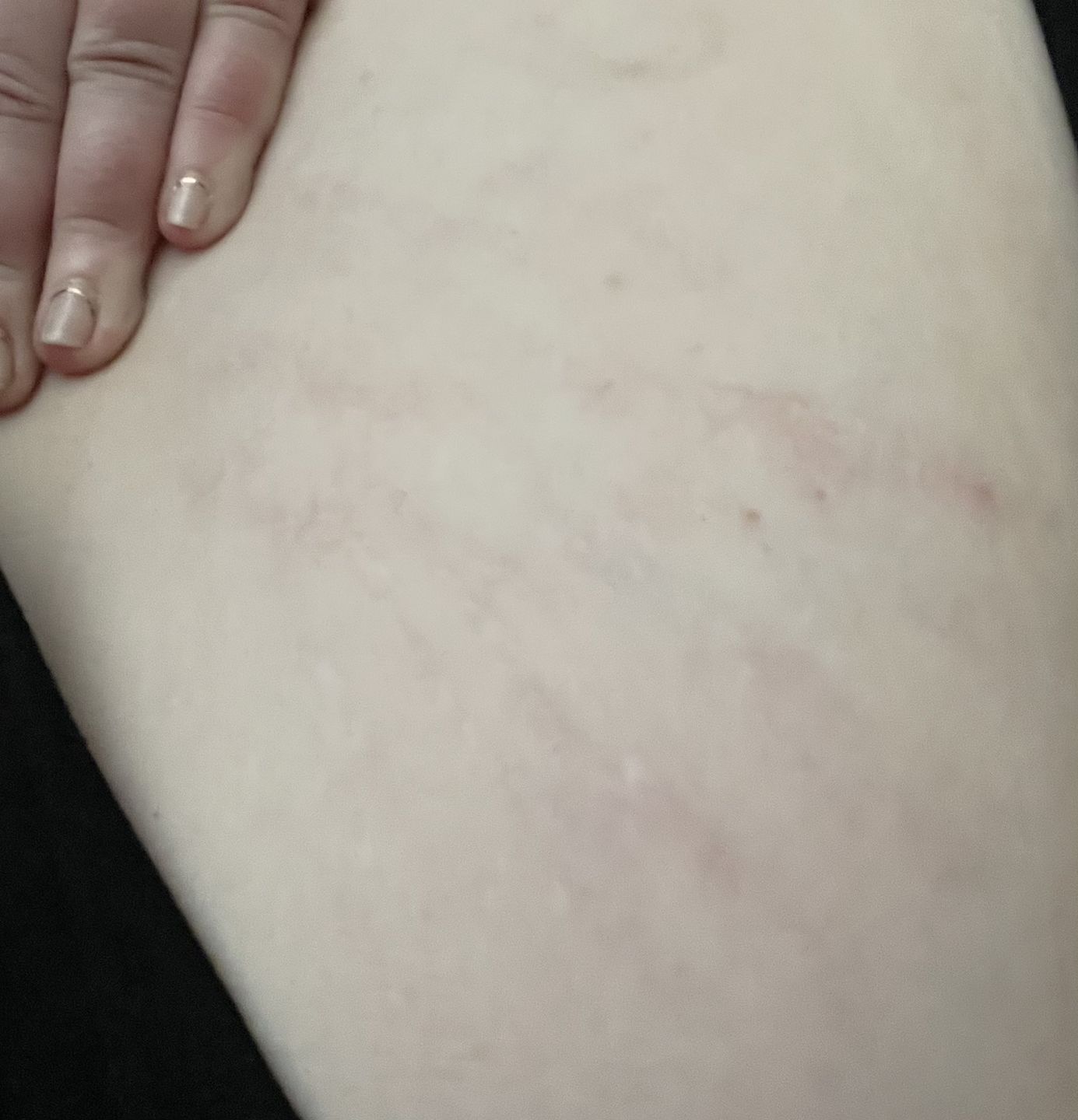 Customer photo review of Magix Cream