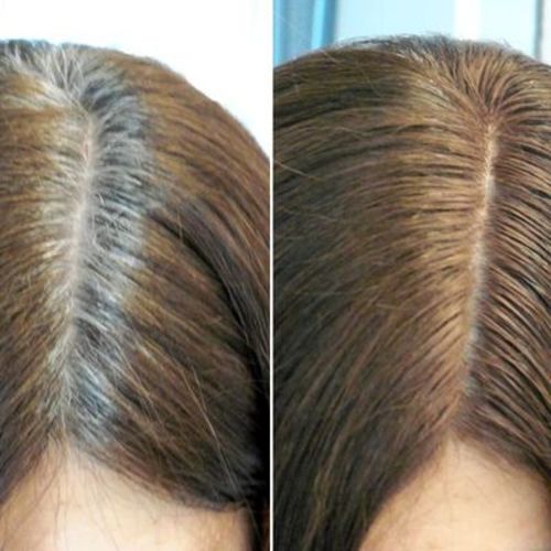 Customer photo review of ÄngelHår™ Hårstärkare & Reparationstvål