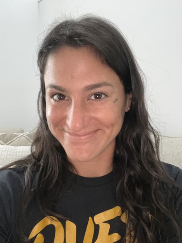 Customer photo review of WrinkleFix: Botox (Existing Customers)