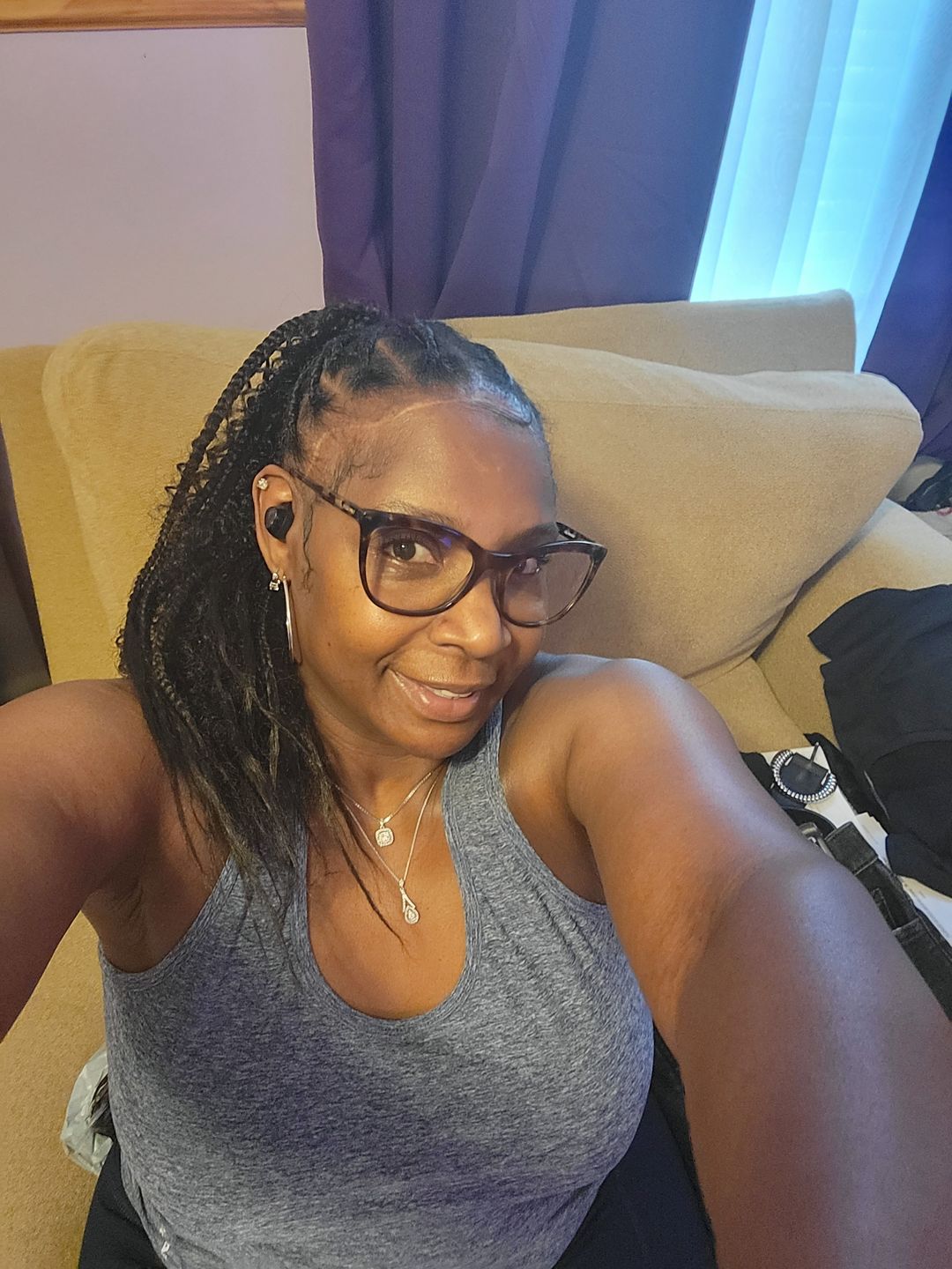 Customer photo review of A-Dream Brightening Eye Cream