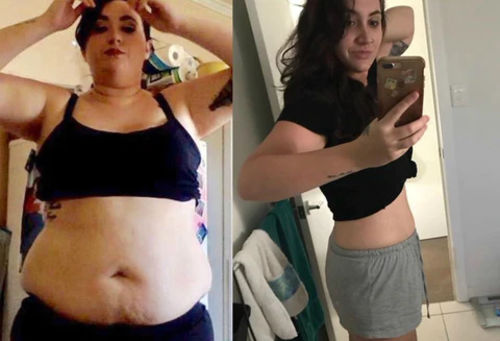 Customer photo review of Boldtique™ Lipo Frysbehandlingskit