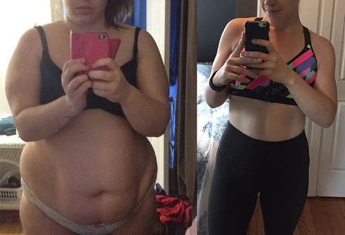 Customer photo review of Boldtique™ Lipo Frysbehandlingskit