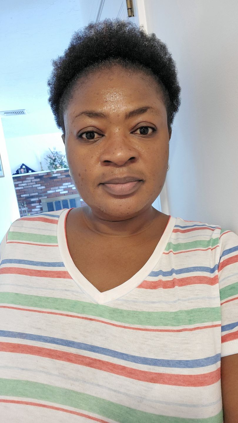 Customer photo review of Fair and White Original Brightening Serum 30 ml / 1 fl oz