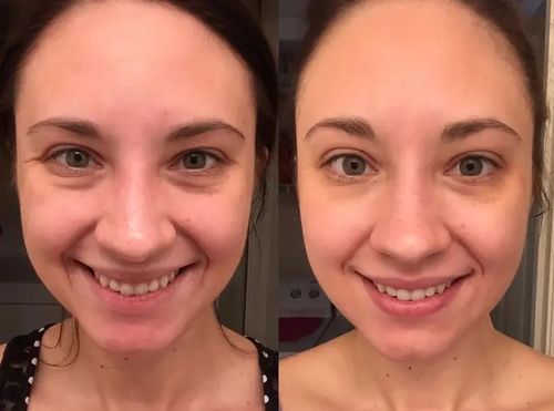 Customer photo review of VarUng™ Kollagenserum