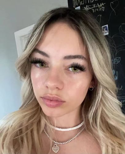 Customer photo review of Hazel Girl Contact Lenses(12 months of use)