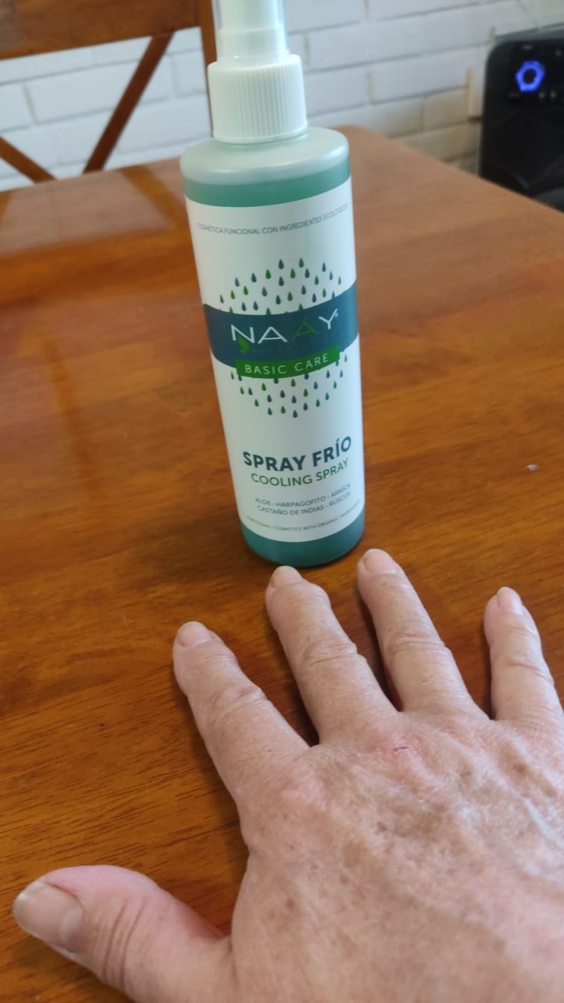 Customer photo review of Calming SPRAY Frío