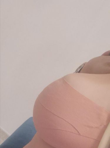 Customer photo review of NASTRO BUUBZ TAPE™ + COPRI CAPEZZOLI