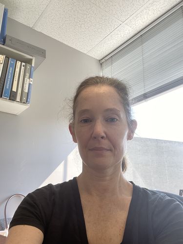 Customer photo review of WrinkleFix: Botox Membership