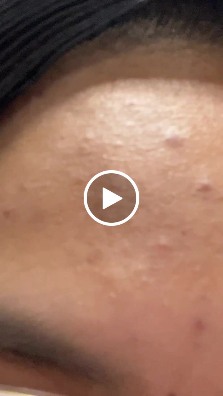 Customer video review of Face Set