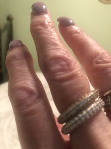 Customer photo review of Icon Ring